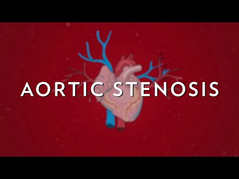Understanding Aortic Stenosis Murmur: Symptoms and Care