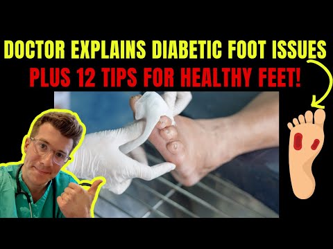 Understanding Diabetic Blisters: Causes, Care, and Prevention post thumbnail image