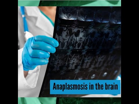 Understanding Anaplasmosis: Symptoms and Treatment Options
