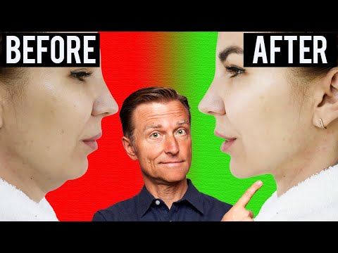 Neck Exercises: What Works and What to Avoid