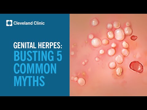 Identifying Common Triggers for Herpes Outbreaks