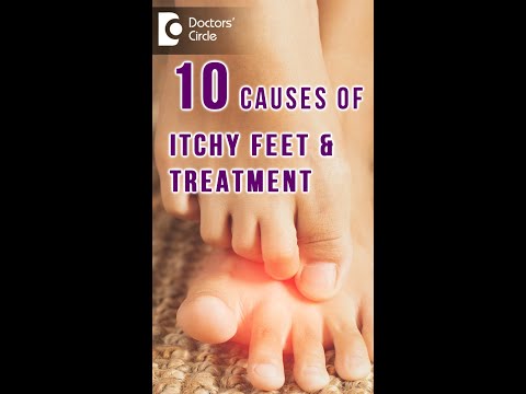 What’s Causing My Itchy Hands and Feet?