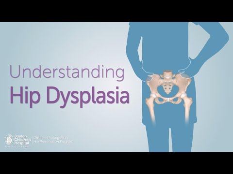 Hip Dysplasia: Understanding Its Causes and Treatment Options