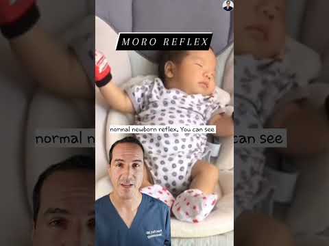 Understanding West Syndrome and Infantile Spasms in Infants