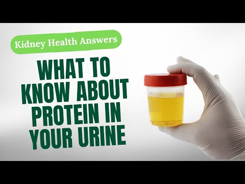 Understanding the Microalbumin Test: What Albumin in Urine Means post thumbnail image