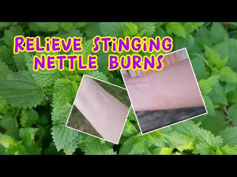 Soothe Stinging Nettle Rash: Remedies and Insights