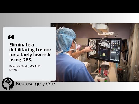 Effective Drug Treatments for Managing Essential Tremor