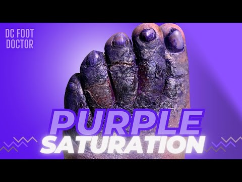 Gentian Violet Topical: Essential Info on Uses and Risks