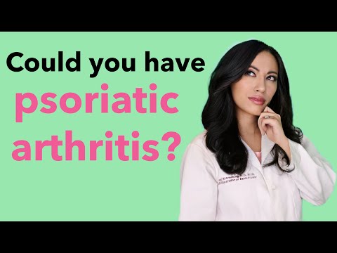Recognizing 8 Key Symptoms of Psoriatic Arthritis