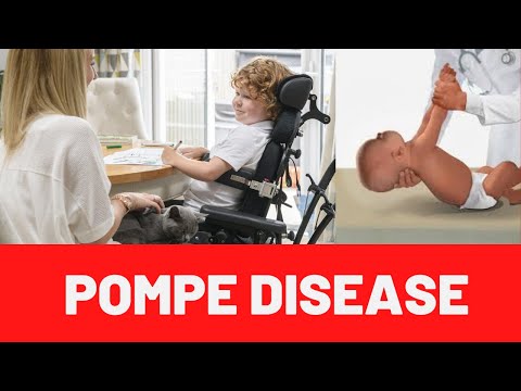 Understanding Pompe Disease: Symptoms, Causes, and Treatments