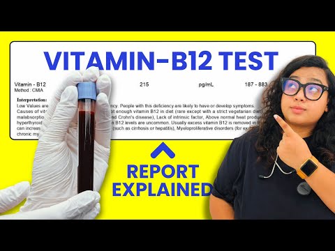Understanding Your Vitamin B-12 Level Test and Its Importance