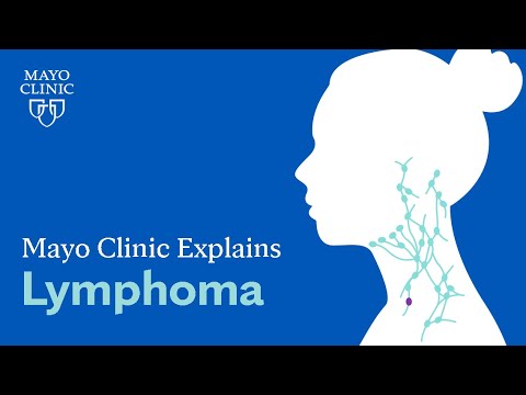 Understanding Small Lymphocytic Lymphoma: Key Symptoms Explained