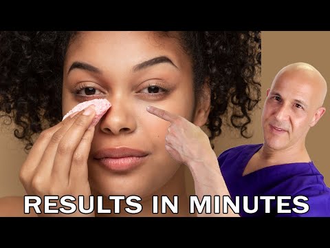 Brightening Your Look: Dark Circles Causes and Solutions