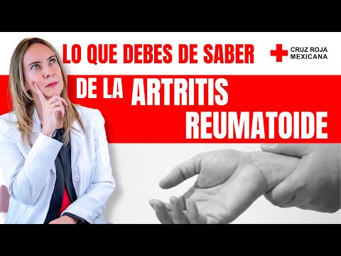 9 Síntomas Tempranos que Indican Artritis Reumatoide