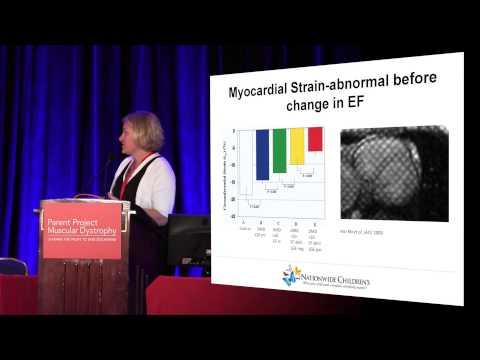 Eplerenone Oral: Uses, Risks, Interactions, and Images