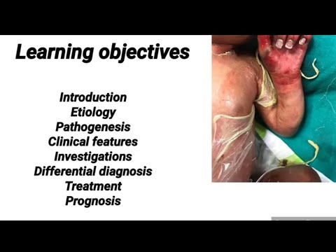 Understanding Scalded Skin Syndrome: Causes and Care Insights post thumbnail image